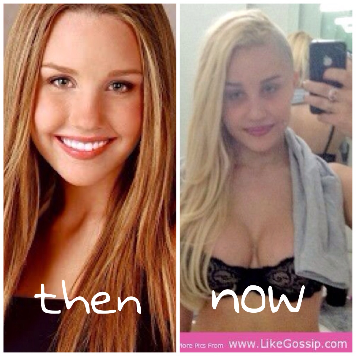 Amanda Bynes - Plastic Surgery Taken Too Far?! | herinterest.com