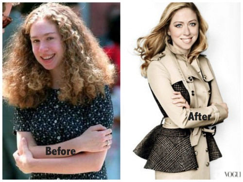 The Truth Behind Chelsea Clinton Plastic Surgery Reports! 