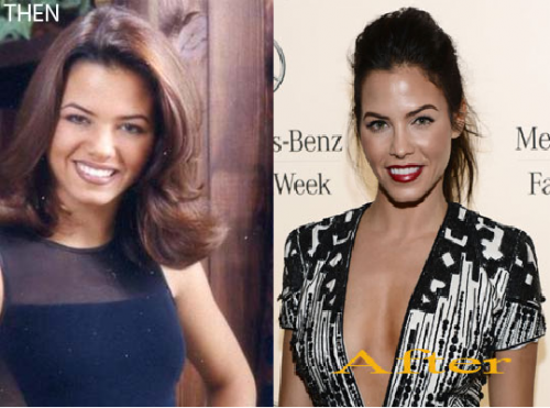 In addition to breast augmentation, Jenna Dewan probably had a nose job. 