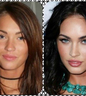 megan fox acne scars