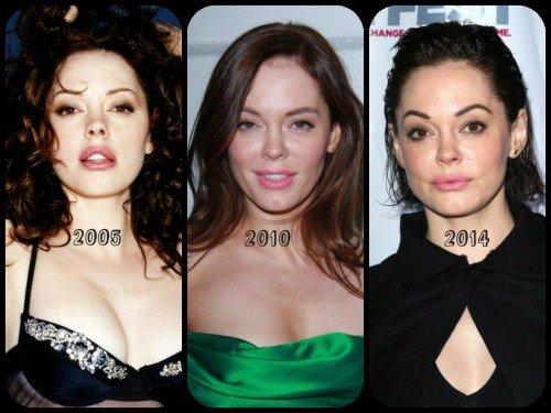 Rose McGowan Plastic Surgery